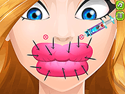 Пластическая операция губ