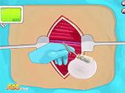 Operate Now! Pacemaker Surgery Walkthrough - Games - Y8.COM