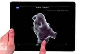 Interactive 3D Medical Animation