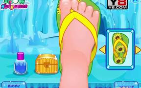 Doctor Anna Foot Walkthrough - Games - VIDEOTIME.COM