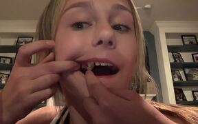 Parrot Pulls Out Girl's Tooth - Animals - VIDEOTIME.COM