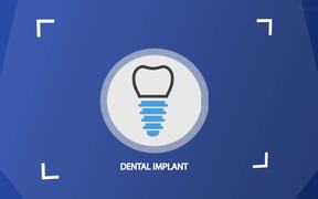 Affordable Dental Implants in Costa Rica