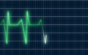 ECG Heartrate Graph Animation