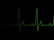 ECG Heartrate Graph