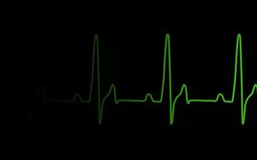 ECG Heartrate Graph