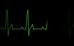 ECG Heartrate Graph - Tech - VIDEOTIME.COM