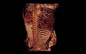 CT Movie of the Vasculature of a Domestic Pig